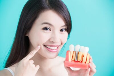 young woman holding dental implant mold and pointing to her smile