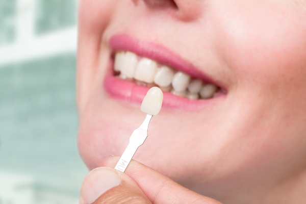 3 Questions to Ask Your Dentist Before Getting Dental Veneers from Integrity Family Dental in Denver, CO