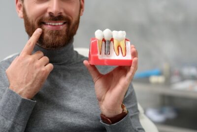 man pointing to his mouth and holding a dental implant mold