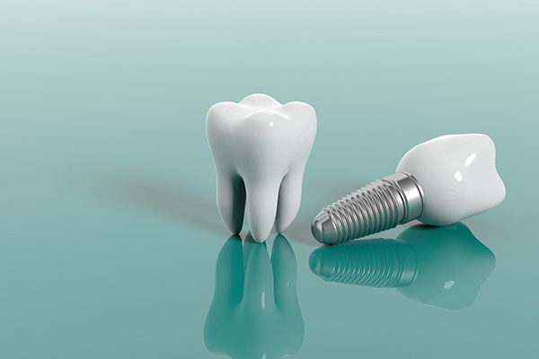 Cosmetic Dental Services Options With Implants from Integrity Family Dental in Denver, CO