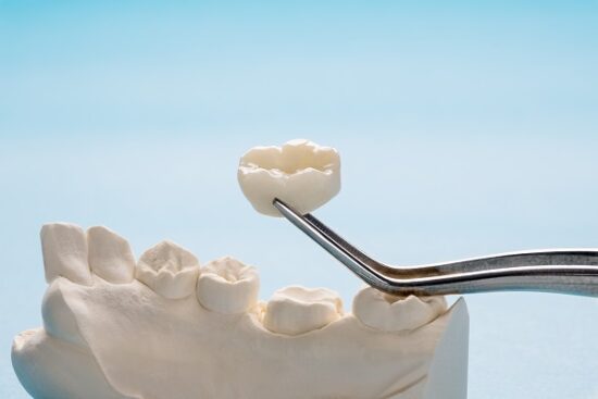 dental pliers holding a dental crown