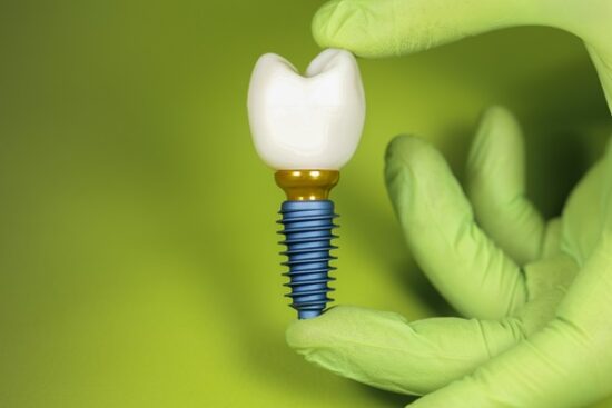 a single dental implant