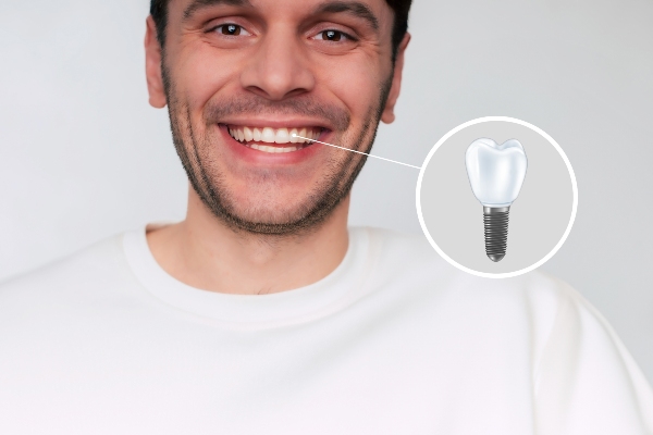 Dental Implants vs. Other Tooth Replacement Options from Integrity Family Dental in Denver, CO