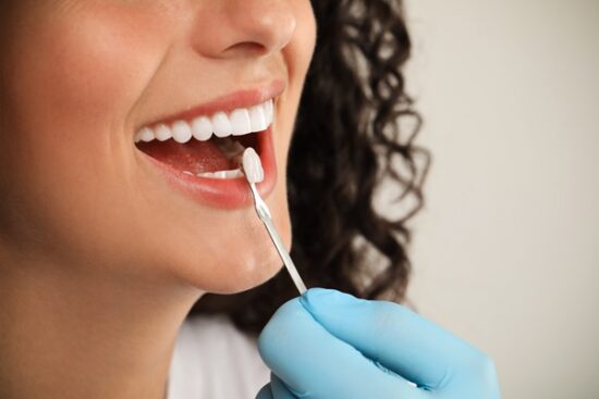 dentist using shade guide on a person's smile