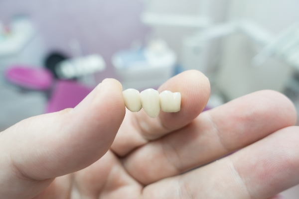 Exploring Different Options for Dental Bridges and Their Benefits from Integrity Family Dental in Denver, CO