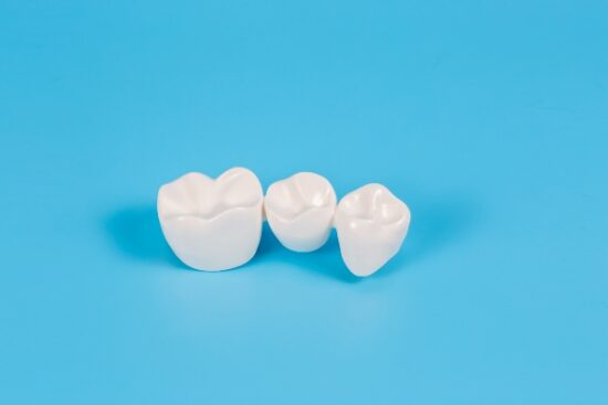 a single fixed dental bridge