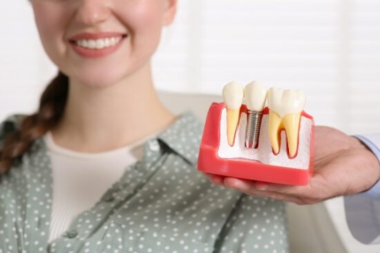 female patient and dentist holding a mouth mold with a dental implant