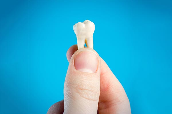 A General Dentist Helps You Decide Whether To Pull or Save a Tooth from Integrity Family Dental in Denver, CO