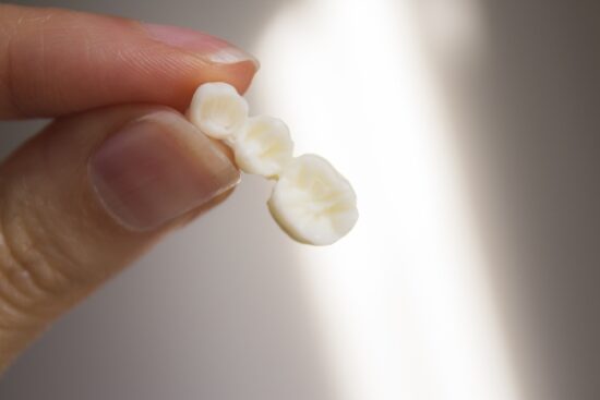 up-close view of a hand holding a dental bridge