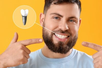 man with a beard pointing to his smile and single dental implant