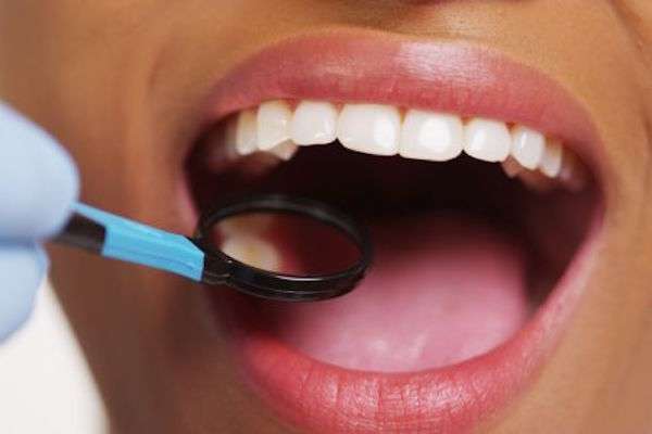 How a General Dentist Treats Cavities from Integrity Family Dental in Denver, CO
