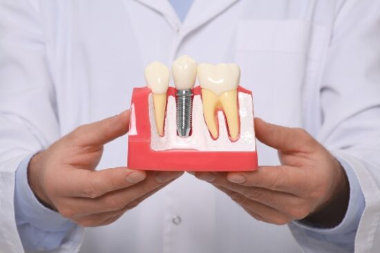 dentist holding mouth mold with dental implant