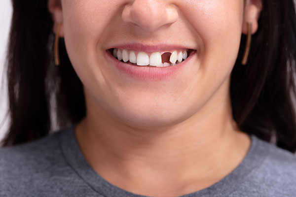 Options for Replacing Missing Teeth With Cosmetic Dental Services from Integrity Family Dental in Denver, CO