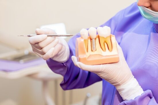 dentist pointing to a dental implant with a specialized instrument