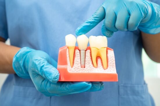 finger pointing to a single dental implant