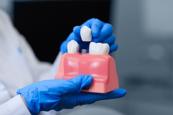 The Process of Getting a Dental Implant After a Tooth Extraction from Integrity Family Dental in Denver, CO