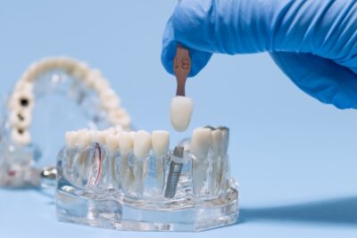 Implant dentist placing a restoration